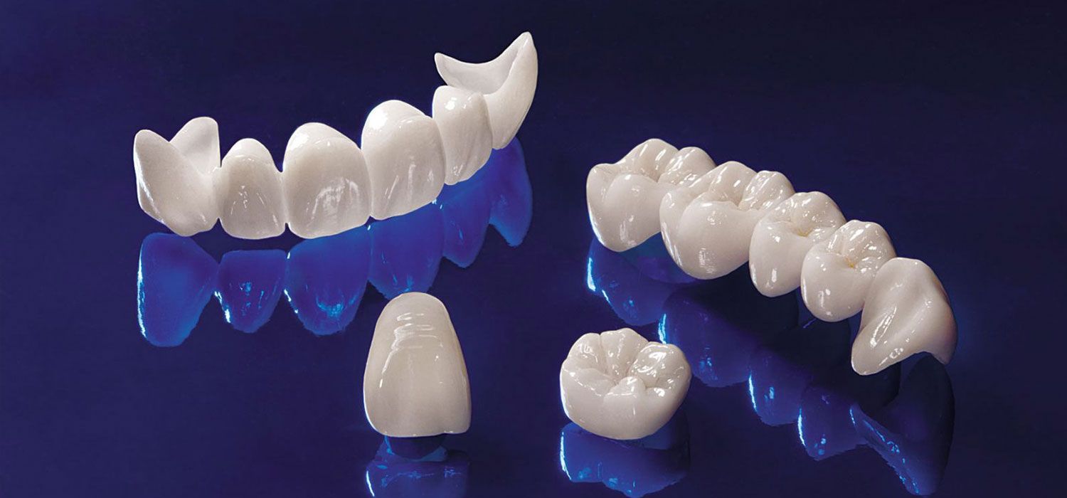 dental crown treatment turkey