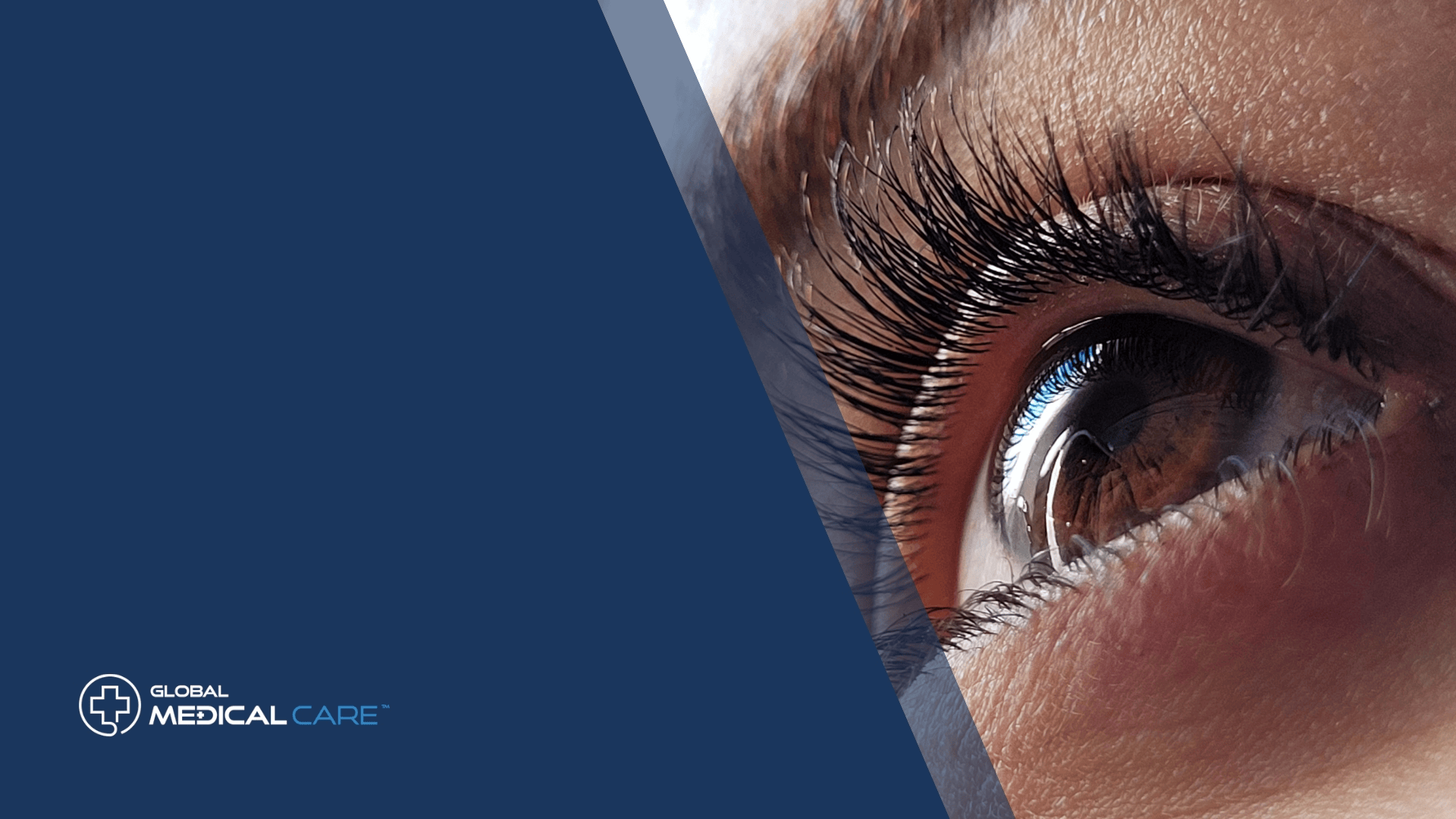 Lächeln LASIK Augenchirurgie Truthahn