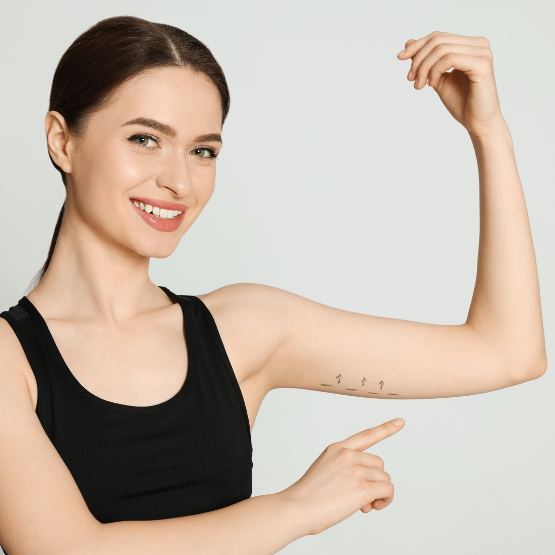 Arm lifting surgery turkey