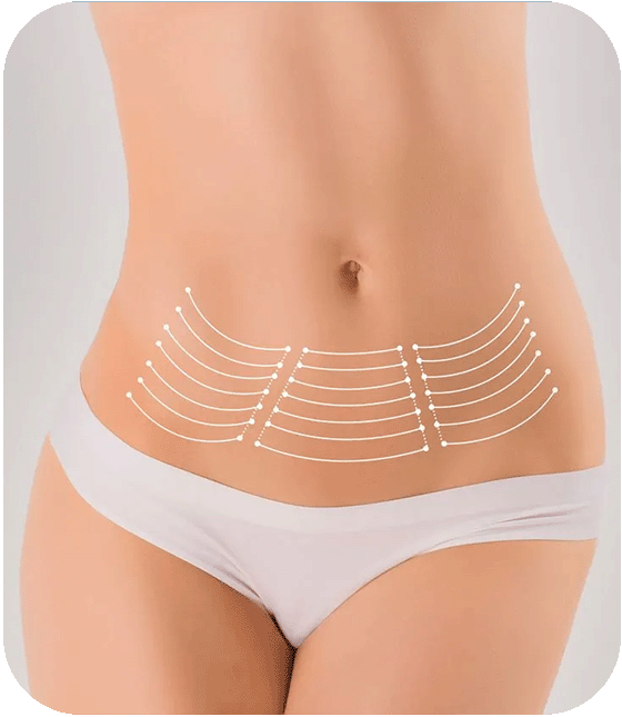 Post-bariatric surgery turkey